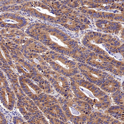 Argonaute 2 Recombinant Rabbit mAb (S-2620-13)