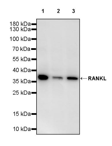 RANKL Recombinant Rabbit mAb (S-2636-218)