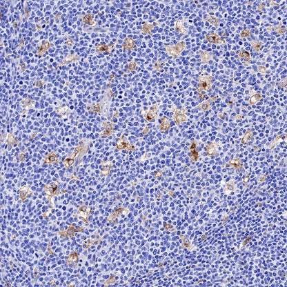 Apolipoprotein E/APOE Recombinant Rabbit mAb (S-970-75)