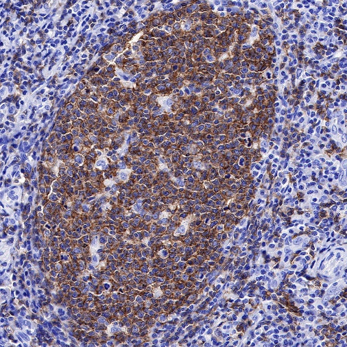 CD20 Recombinant Rabbit mAb (SDT-038-205)