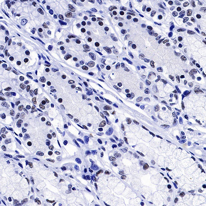 U2AF2 Recombinant Rabbit mAb (S-1324-66)