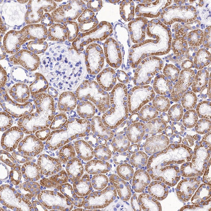 SDHB Recombinant Rabbit mAb (SDT-1162-2)