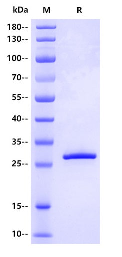 Human Calretinin Protein, His tag