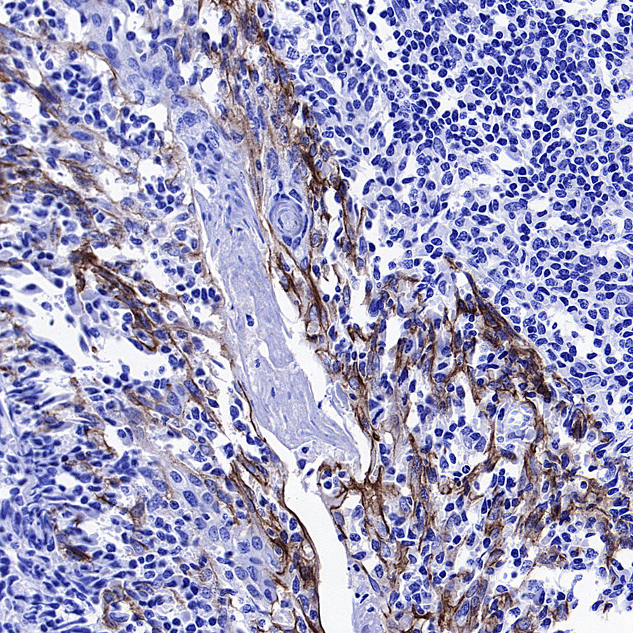 CDH3 Recombinant Rabbit mAb (S-3576-116)