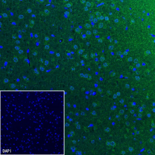 UCHL1 Recombinant Rabbit mAb (S-1765-38)