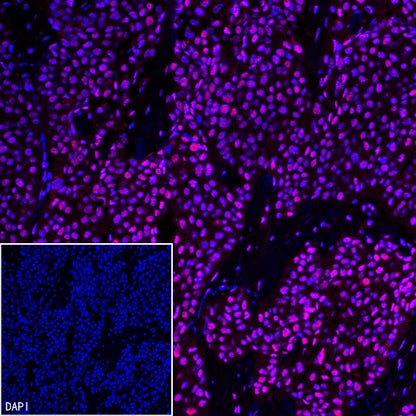 U2AF2 Recombinant Rabbit mAb (S-1324-66)