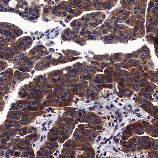 Keap1 Recombinant Rabbit mAb (S-1520-8)