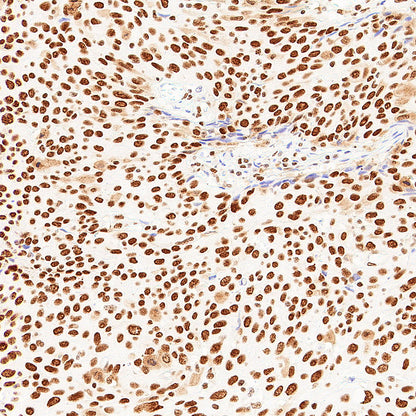 pan Brd4 Recombinant Rabbit mAb (S-6208)