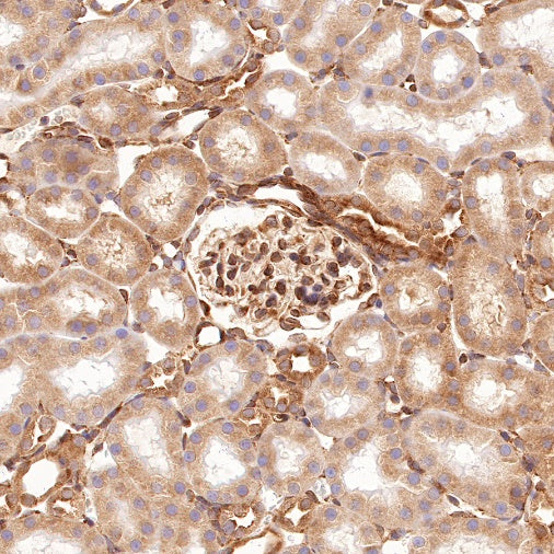 Argonaute-2 Recombinant Rabbit mAb (S-1826-47)