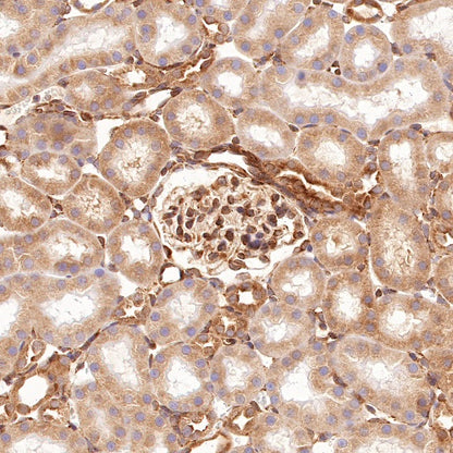 Argonaute-2 Recombinant Rabbit mAb (S-1826-47)