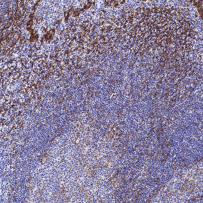 Podoplanin (D2-40) Recombinant Rabbit mAb (SDT-1178-8)
