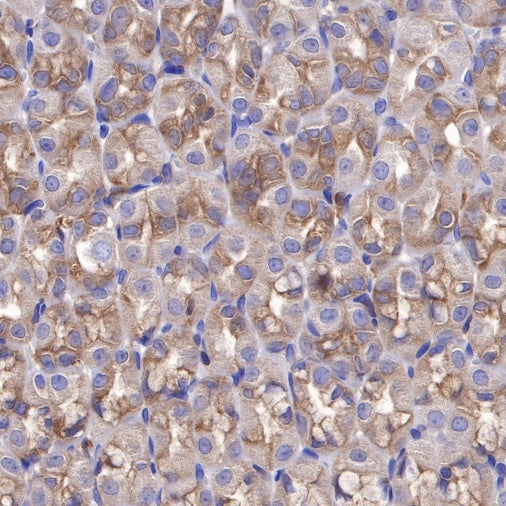 PI3 Kinase p85α Recombinant Rabbit mAb (S-328-24)