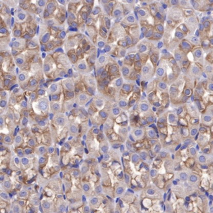 PI3 Kinase p85α Recombinant Rabbit mAb (S-328-24)
