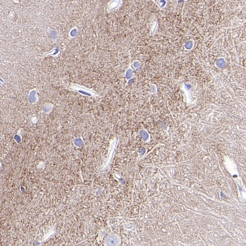 Tenascin C Recombinant Rabbit mAb (S-775-274)