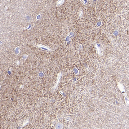 Tenascin C Recombinant Rabbit mAb (S-775-274)