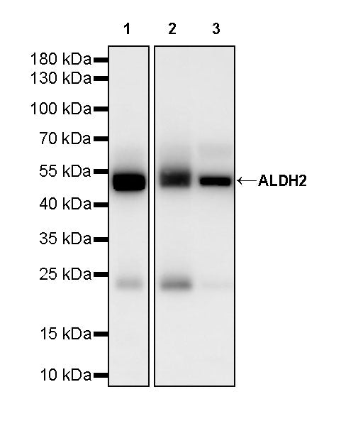 ALDH2 Mouse mAb