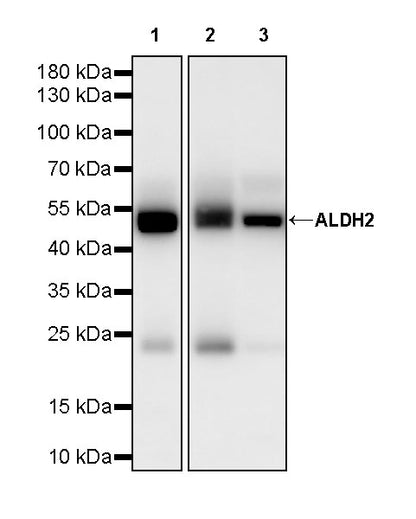 ALDH2 Mouse mAb