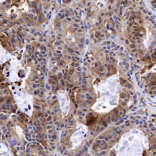 S-RMab® GST-π Recombinant Rabbit mAb (SDT-561-78)