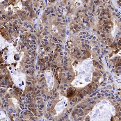 S-RMab® GST-π Recombinant Rabbit mAb (SDT-561-78)