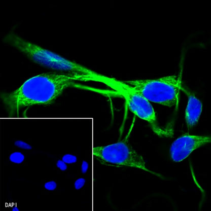 β-tubulin Recombinant Rabbit mAb (SDT-312-113)