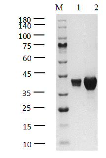 AAK1 His Tag Protein, Human