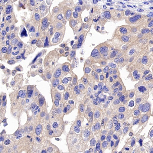 Beclin-1 Recombinant Rabbit mAb (S-761-15)