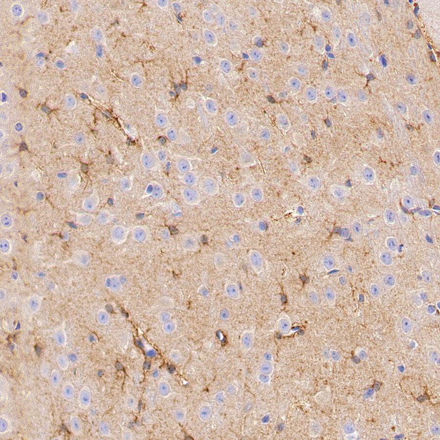 PITX2 Recombinant Rabbit mAb (S-4009-54)