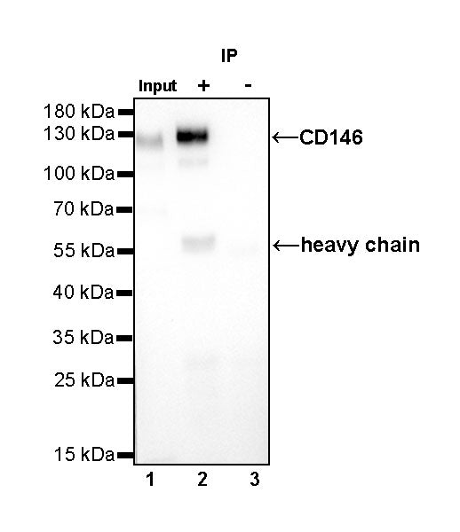 CD146 Recombinant Rabbit mAb (SDT-348-6)