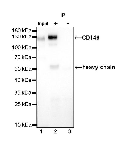 CD146 Recombinant Rabbit mAb (SDT-348-6)
