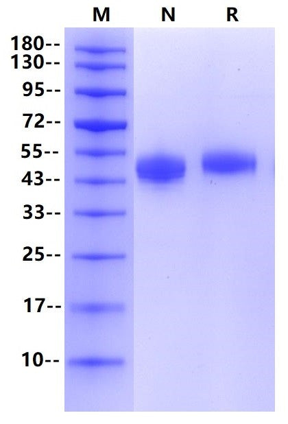 SIRP-α His Tag Protein, Human
