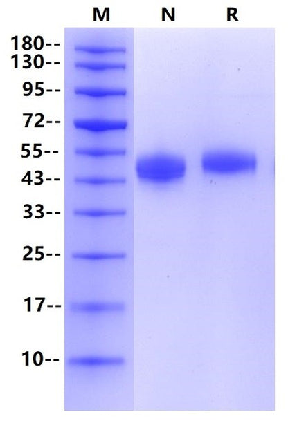 SIRP-α His Tag Protein, Human
