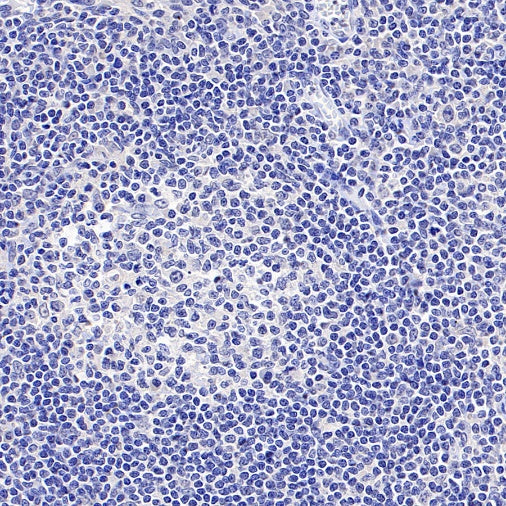 ASGR1 Rabbit Polyclonal Antibody