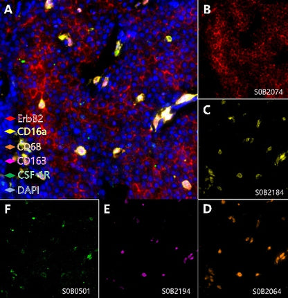 ErbB2, CD16a, CD68, CD163, CSF-1R Antibody Panel
