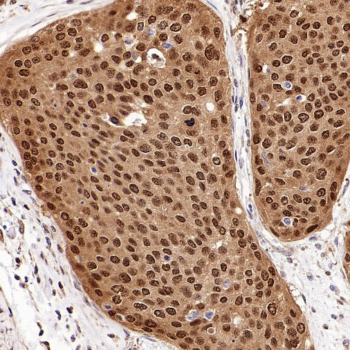 SMAD3 Recombinant Rabbit mAb (S-3147-36)