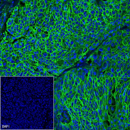 NaK-ATPase Recombinant Rabbit mAb (S-1373-39)