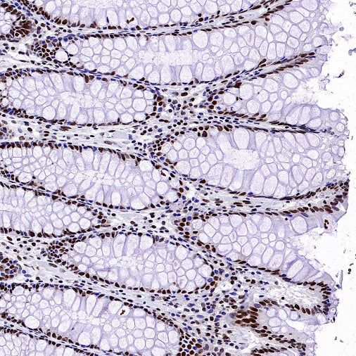 Symmetric Dimethyl Arginine (SDMA) Rabbit mAb (S-2129-14)