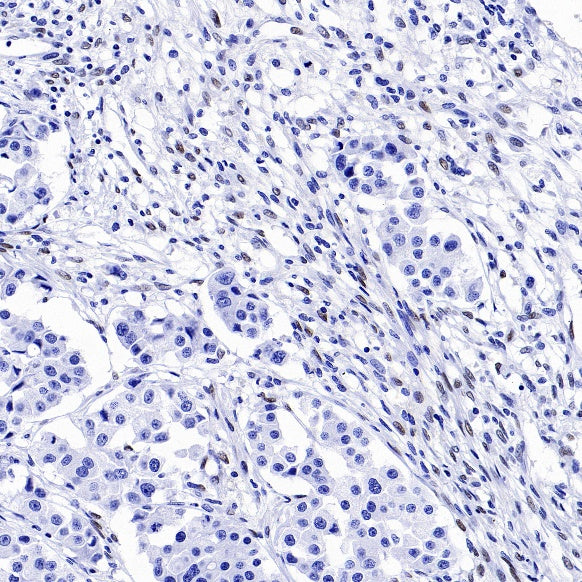 ZEB1 Recombinant Rabbit mAb
