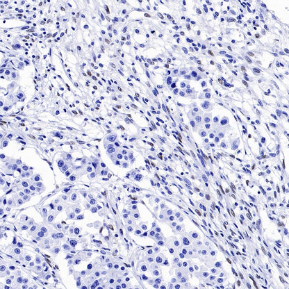 ZEB1 Recombinant Rabbit mAb