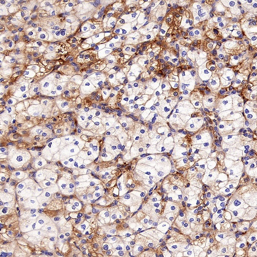 EEA1 Recombinant Rabbit mAb (S-2604-39)