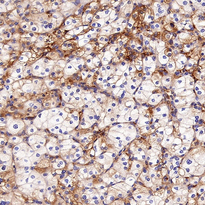 EEA1 Recombinant Rabbit mAb (S-2604-39)