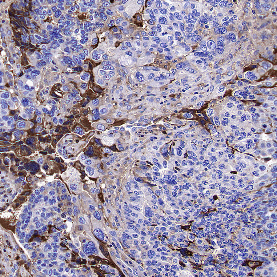 Apolipoprotein CIII Recombinant Rabbit mAb (S-5408)
