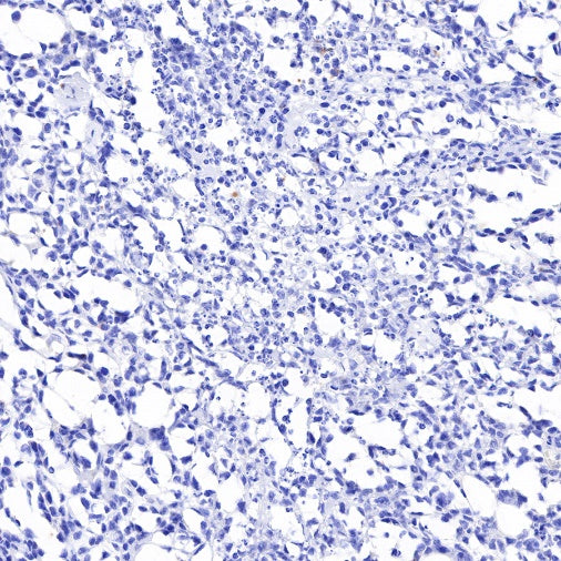 NKX2.2 Recombinant Rabbit mAb (SDT-898-41)
