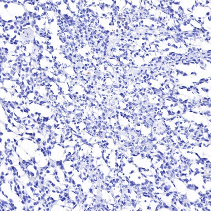 NKX2.2 Recombinant Rabbit mAb (SDT-898-41)