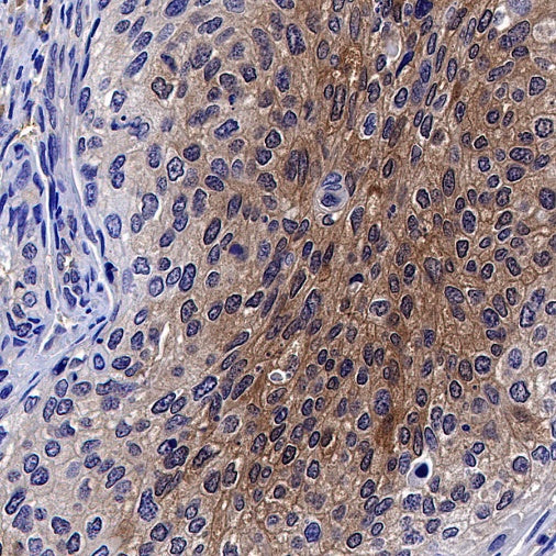 MIF Recombinant Rabbit mAb (S-1007-34)