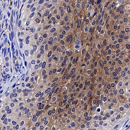 MIF Recombinant Rabbit mAb (S-1007-34)