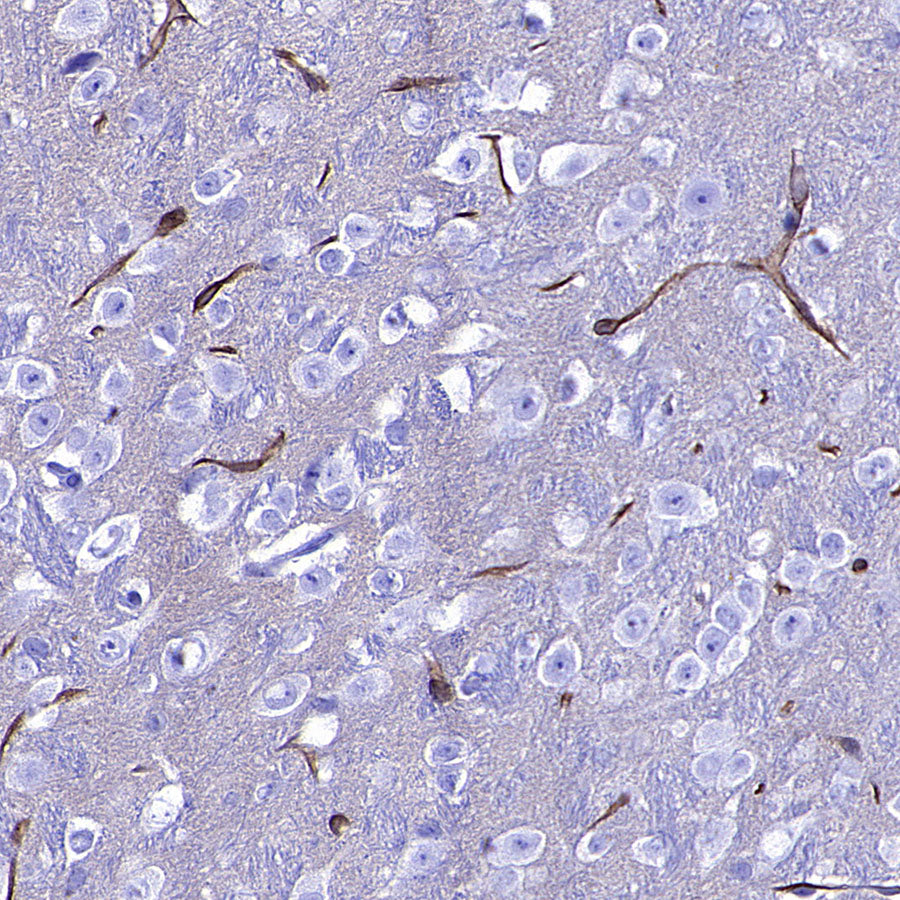 SLC7A5 Recombinant Rabbit mAb (S-4496-55)