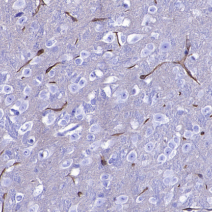 SLC7A5 Recombinant Rabbit mAb (S-4496-55)