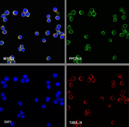 PPP2R1A Rabbit Polyclonal Antibody
