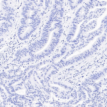 ALPP/ALPPL2 Recombinant Rabbit mAb, PBS Only (SDT-2088-32)