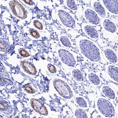 KLK5 Recombinant Rabbit mAb (S-4238-55)